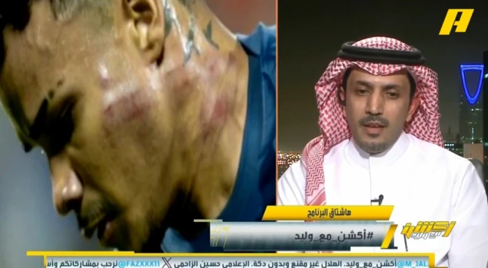 بالفيديو: الزلال يعلق على إصابة لاعب الهلال " كايو" أمام العدالة