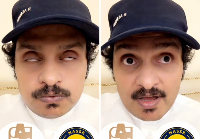 بالفيديو..الصبحان يتوقع نتيجة مباراة النصر والدرعية في الدوري